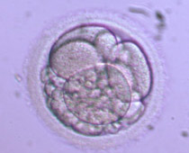 4-cell Grade II-III